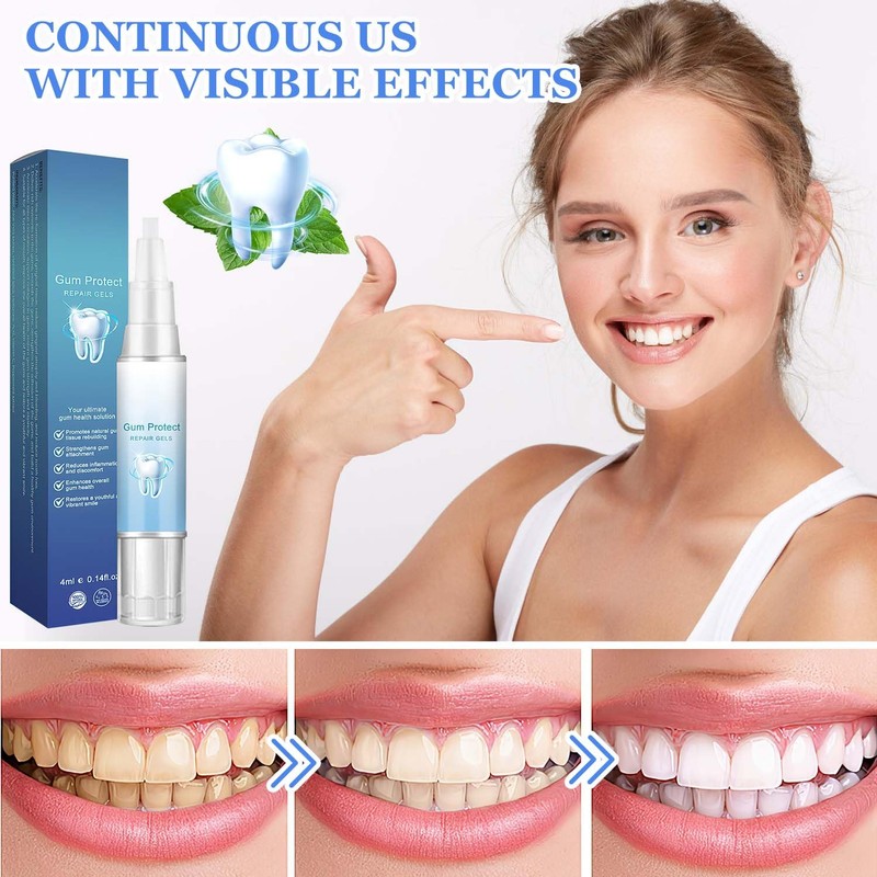 BSOON Gum Therapy Gel, Pack of 3 Teeth Whitening Pen