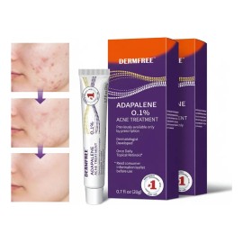 2pcs Gel Facial Anti Piel Acne Contiene Adapalene Todo Tipo Día Noche