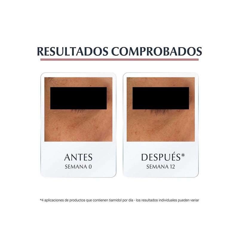 Crema contorno de ojos Eucerin despigmentante y anti-ojeras día y