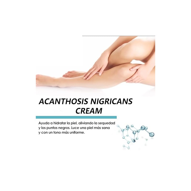 2 Pcs Acanthosis Nigricans Crema, Crema Correctora de Manchas Oscuras
