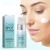 Tkekruh Dark Spot Remover for Face