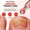 Ingrown Toenail Treatment Kit with Precision Clippers & Drops