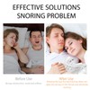SSKHE Anti Snoring Splint,Washable & Reusable,Prevent Snoring from Disturbing Sleep