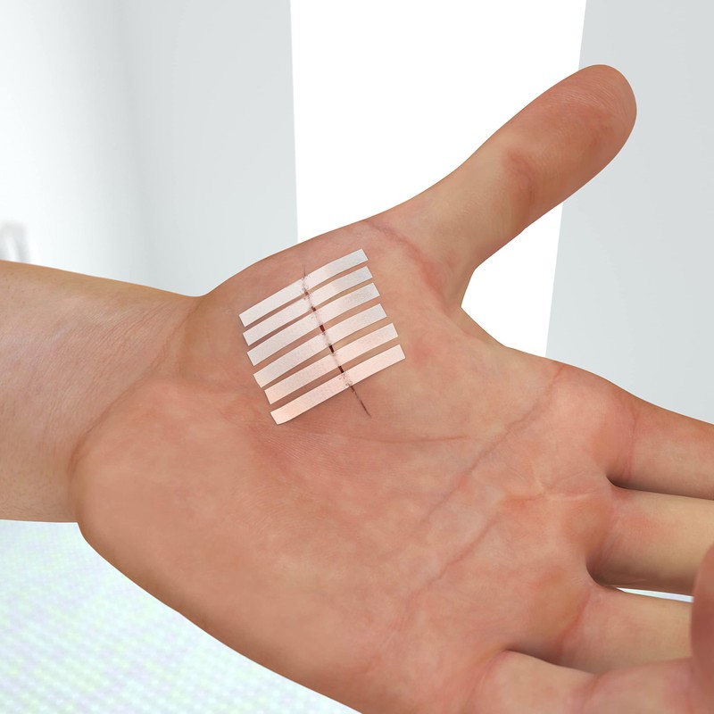 250 JFA Medical Wound Closure Strips (3 x 75mm) -