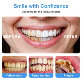 3-Piece Stainless Steel Teeth Cleaning Tool Kit with Mirror – Plaque & Tartar Remover Set for Oral Care, Tooth Scraper Picks for Home Use