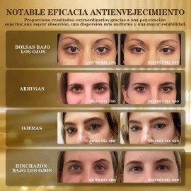 Parches Hydrogel Contorno Ojos Ácido Hialurónico Anti Ojeras Bolsas Antiarrugas Hidratante 60Pzs