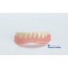 Instant Smile Lower Teeth