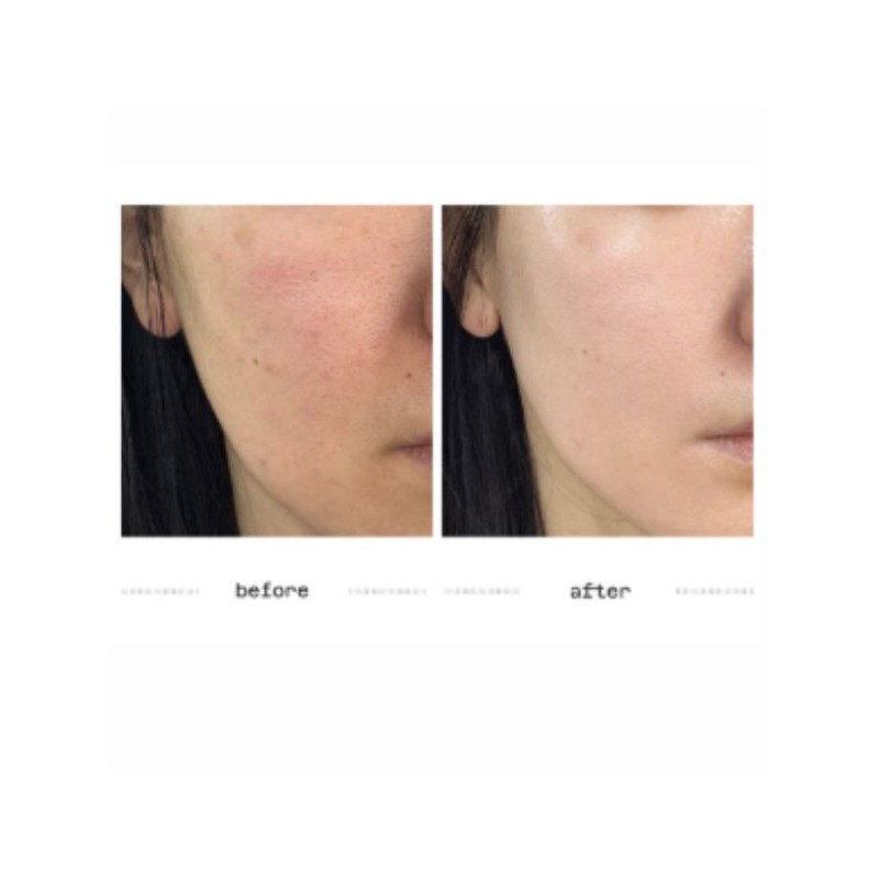 ATHE Melaser Programming Amoule For Melanin Care 10ml*2ea(For 2weeks Routine)