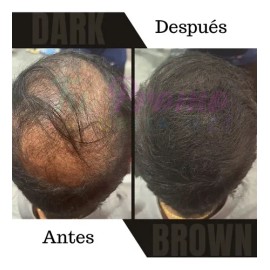 Fibras Capilares De Queratina 27.5g Volumen A Cabello Barba