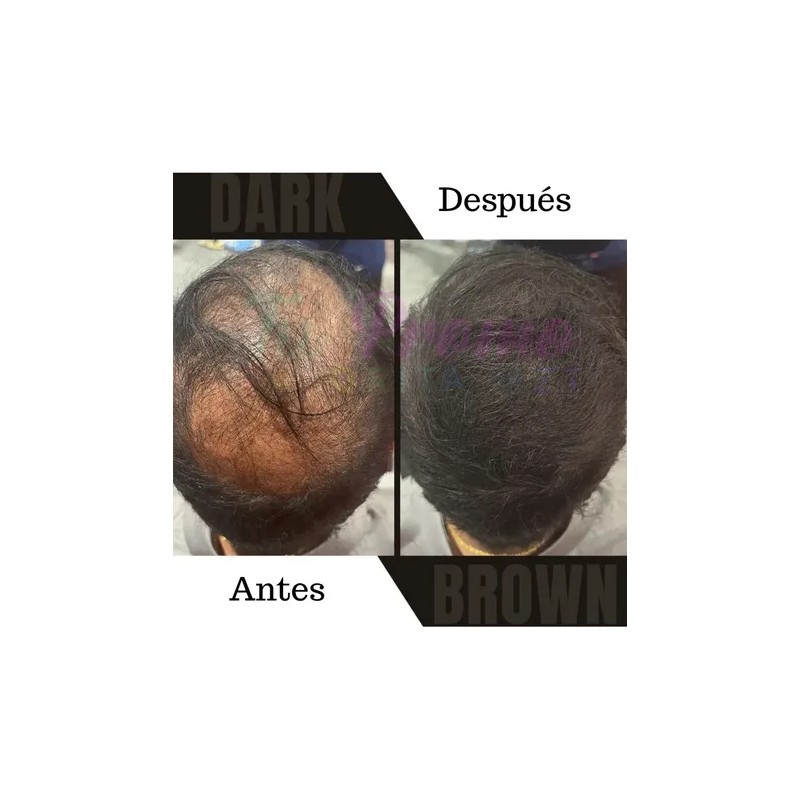 Fibras Capilares De Queratina 27.5g Volumen A Cabello Barba