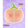Halloween Cute Cat Acne Pimple Patches for Face, Hydrocolloid