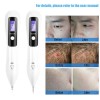 Unbranded Portable LCD Dot Mole Freckle Spot Tattoo Removal Pen
