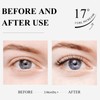 BREYLEE Eyelash Growth Serum, Eyelash Serum for Eyelash Growth Lash
