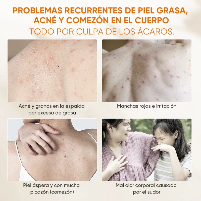QUARXERY Gel de ducha antiácaros body wash - Eliminación profunda