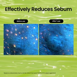 beplain beplain Mung Bean Cleansing Oil(6.76fl.oz/200ml)| Fragrance-Free | Non-Comedogenic Tested| Makeup Blackhead Remover & Deep Pore Cleanser| Suitable for Sensitive Skin| Double Cleansing Korean Skincare