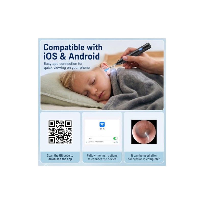 Ear Wax Removal Kit with Camera, 1080P Wireless Ear Cleaner