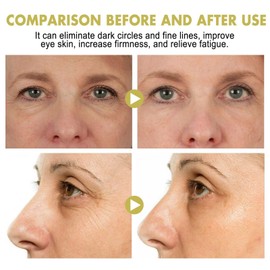 Snail Peptide Eye Cream Stick,Anti-Aging E/ye C/ream for Puffiness,Collagen Anti Wrinkle Ey/e Balm S/tick,Ey/e Serum Stick for Eye Bags,Under Ey/e Cream,Anti Wrinkle E/ye Cream,Eye Bag Balm for Woman