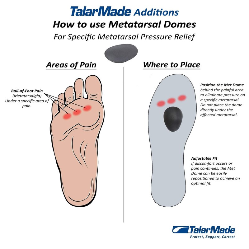 TalarMade Surface Additions Metartarsal Domes Forefoot Raise - Mortons Neuroma