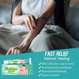 Crema para psoriasis y eczema, crema antipicazón de hierbas chinas naturales, crema para eczema para aliviar la piel seca y con picazón, hidratación a base de plantas, crema humectante (0.7 onzas (Paquete de 5))