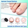 17pcs Ingrown Toenail Corrector Set, Professional Ingrown Toenail Pedicure Tools