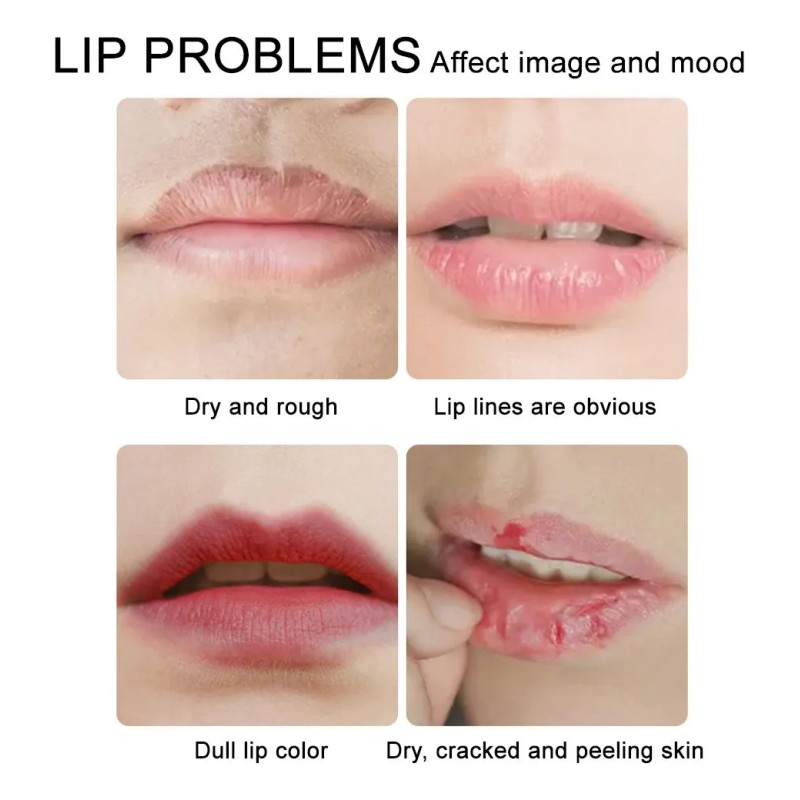 Máscara Labial Hidratante 60g Pares Reduce Arrugas