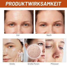 100 ml Herbal Spots Peel-Off Face Mask, Anti-Wrinkle Peel-Off Face Mask, Herbal Spots, Peel-Off Mask, Deep Face Mask for All Skin Types