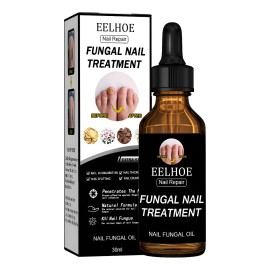 Lquido Reparador Y Nutritivo For El Tratamiento De as - Producto Original de Alta Calidad, Entrega Rápida y Segura, Garantía Incluida                 