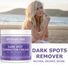 Whitening Labs Dark Spot Corrector - Anti-Aging Moisturizer for Face,