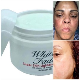Jacvon LLC WHITE FADE CREAM: SUPER SKIN LIGHTENER TO REMOVE DARK SPOTS, SIZE 2oz.