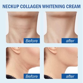 Neck Firming Cream,Neck Tightening Cream,Collagen Neck Cream,Neck Firming Cream Tightening Lifting Sagging Skin,Anti Wrinkle Cream for Women,Anti Aging Cream,Strengthen Neck Skin Tightening Cream,20g