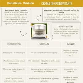 Crema Despigmentante Facial Anti Manchas Piel, Extracto de Flor de Margarita y Vitamina C, Aclaradora e Hidratante para Rostro, 30ml