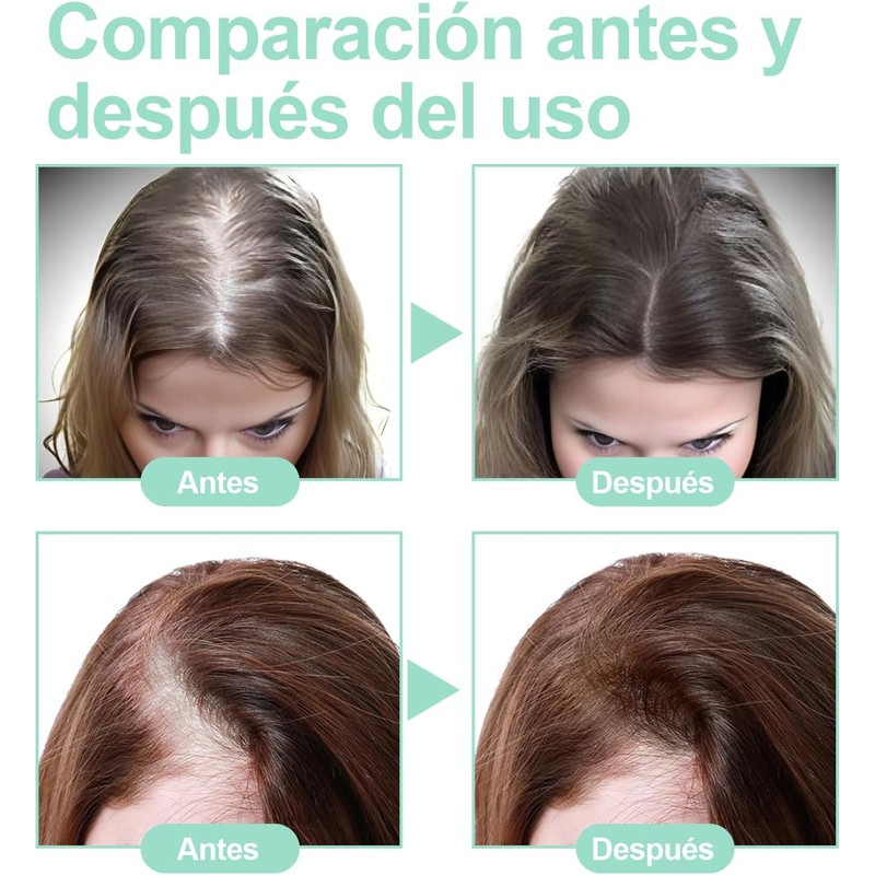 Aceite De Romero：Aceite de Romero para El Cabello-100%, Aceite Esencial