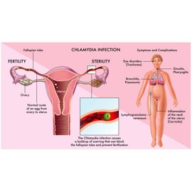SUPPLEMENTS4M INFERTILIDAD DE LAS MUJERES - TRATAR EMBARAZADA CONCEBIR - 120 PILLS MADE IN USA