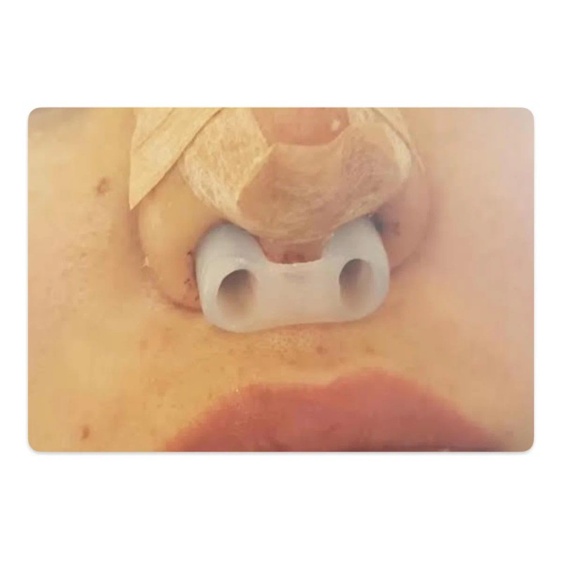 Retenedor Nasal Silicon Rinoplastia Blanco
