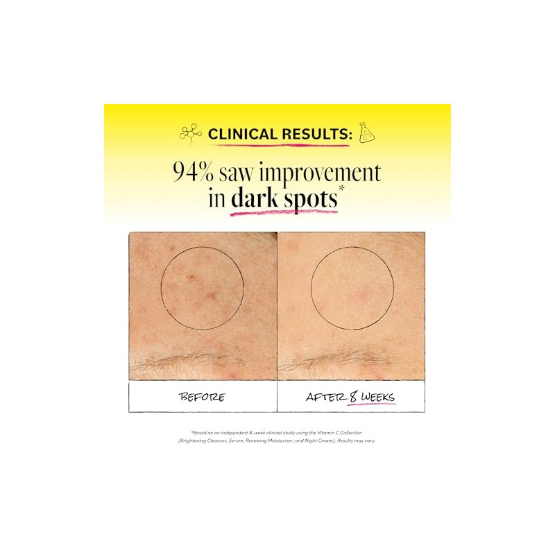 DERMA E Vitamin C Renewing Moisturizer with Probiotics and Rooibos,