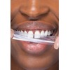 hismile Ultimate Whitening Bundle