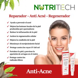 Crema Anti Acne con 9 extractos de flores, plantas y semillas para combatir el acne, puntos negros, limpiar, eliminar espinillas y reducir poros