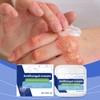 Anti Fungal Skin Cream,Hydrating Anti Fungal Skin Cream for Itch