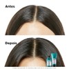 L'Oréal Professionnel |Scalp Advanced |Anti-sensibilidad