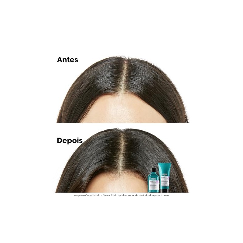 L'Oréal Professionnel |Scalp Advanced |Anti-sensibilidad