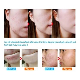 Crema Reparadora De Rostro Y Cuerpo Oxizzinc Kit X Tratamien