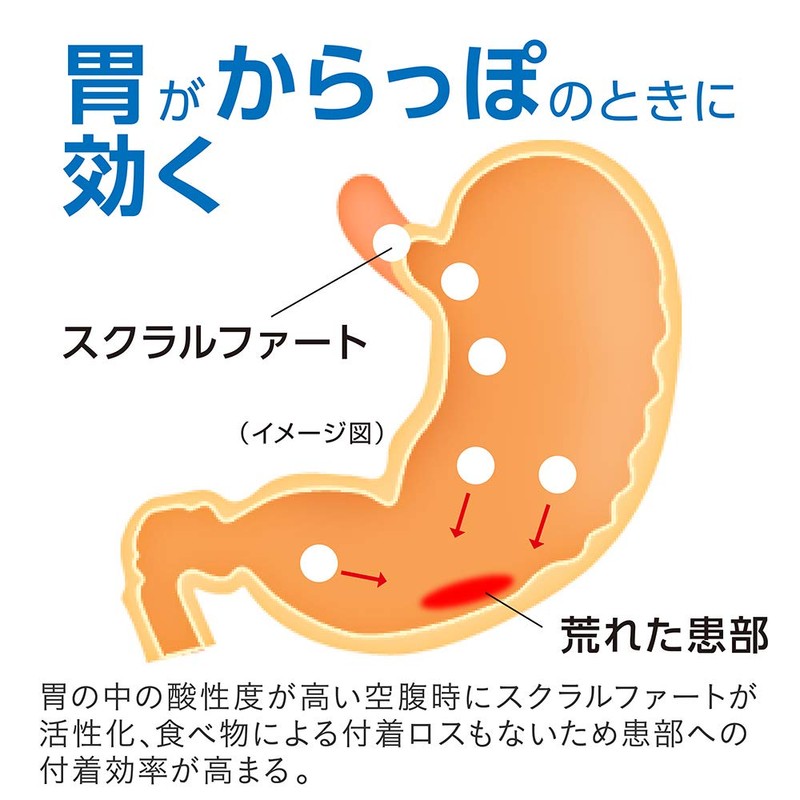 【第2類医薬品】スクラート胃腸薬(錠剤) 102錠