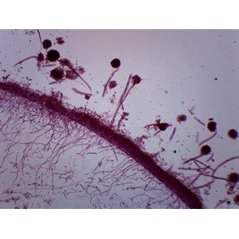 EISCO 10PK Fungi Molds, 3 Types - Wholemount - Prepared Microscope Slides - Classroom Pack, 10 Slides in Storage Case - Biology & Microscopy