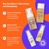 Dermz Acne Treatment - Acne Cream, SPF Face Protection, Face