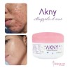 Akny Crema Para Eliminar Acné