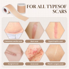 NAYSAYE Silicone Scar Sheets, Silicone Tape for Scars, Scar Tape for Surgical Scars, Silicone Scar Tape for Scars, Scar away Silicone Scar Sheets for All Skin Types (1.6" x 60" Roll-1.5 M)