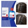 Champú Anticaspa Oil Control 300 Ml Scalp Nourish Para Hombr