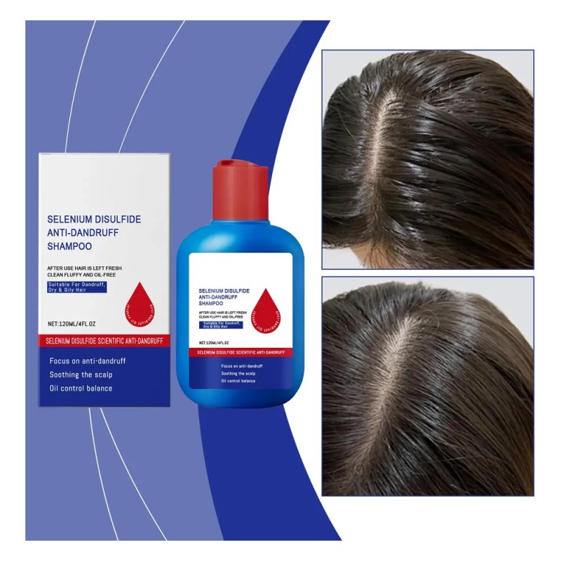 Champú Anticaspa Oil Control 300 Ml Scalp Nourish Para Hombr