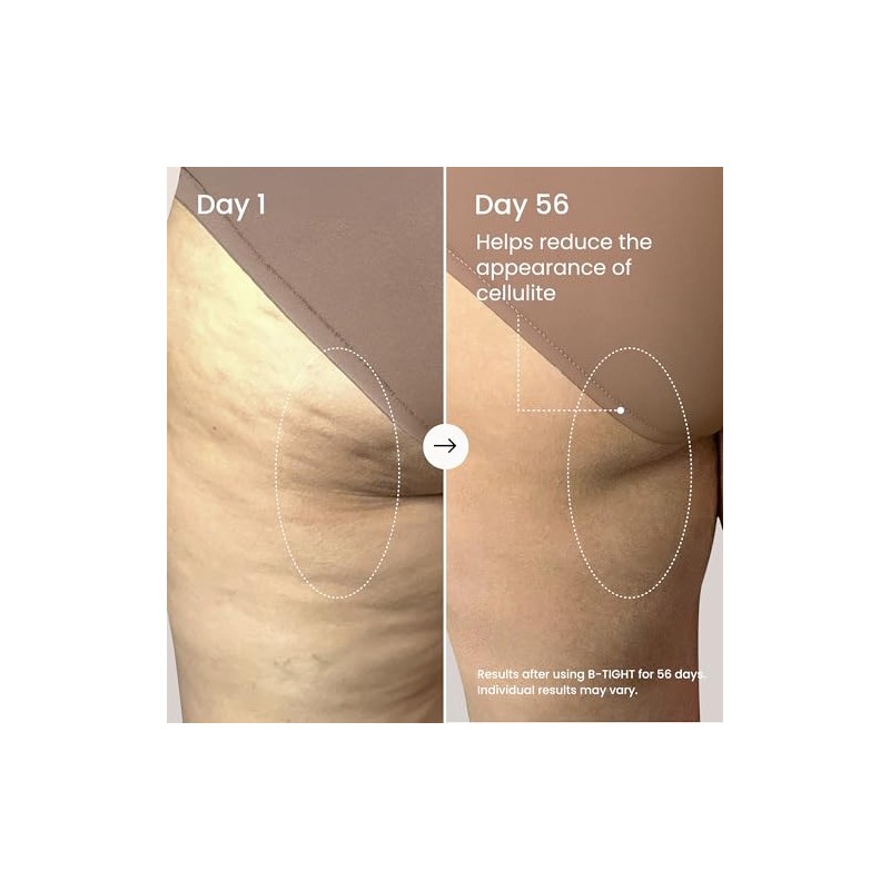B-Tight Cellulite Reduction Lift & Firm Booty Cream by MAELYS
