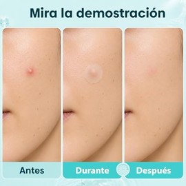 720PCS Parches para Acne, Pimple Patch, Parches para Espinillas, Cubrir Imperfecciones, para Todos Los Tipos de Piel